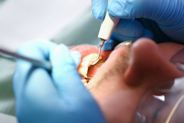 Best Dental Abscess Treatment in Frankfort, IL